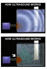 Ultrasonic Blind Cleaning